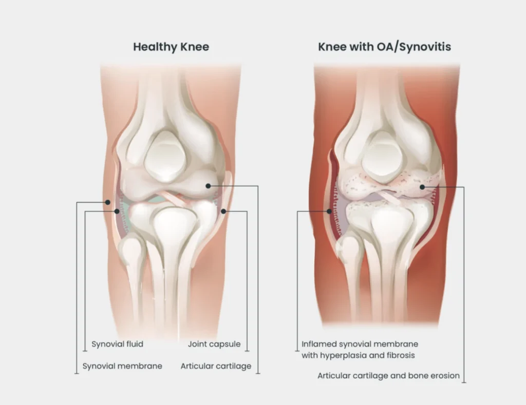 healthy knee